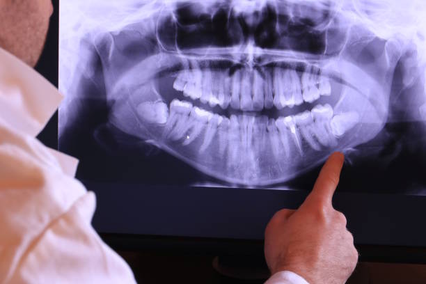 Best Emergency Dentist for Knocked-Out Tooth in Hominy, OK