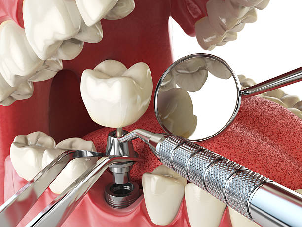Best Emergency Dentist for Knocked-Out Tooth in Hominy, OK